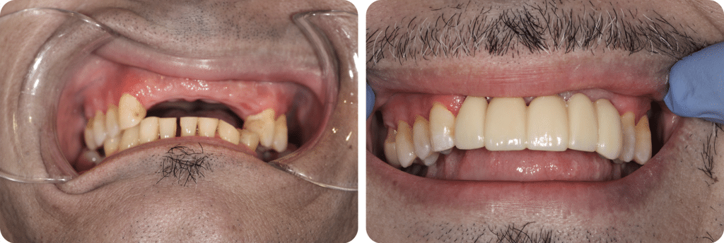 Before and After 1678x564